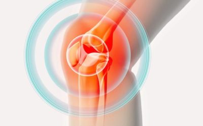 Am I a Good Candidate for Knee Replacement Surgery?