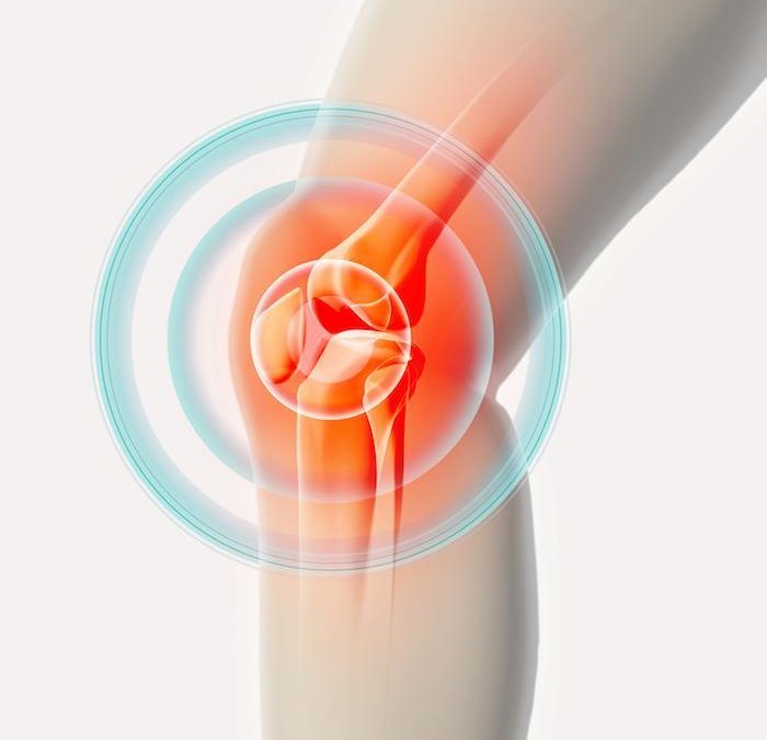 Am I a Good Candidate for Knee Replacement Surgery?