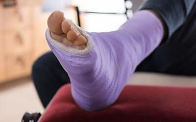 What Is the Typical Recovery Process for a Fracture?