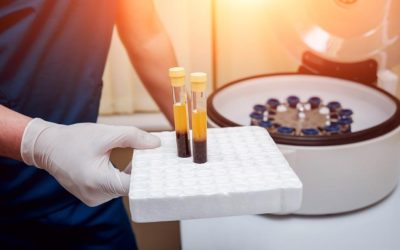 Why Athletes Turn to PRP Before an Injury Happens