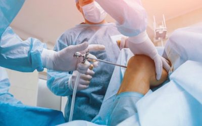 Am I a Candidate for Arthroscopic Surgery?